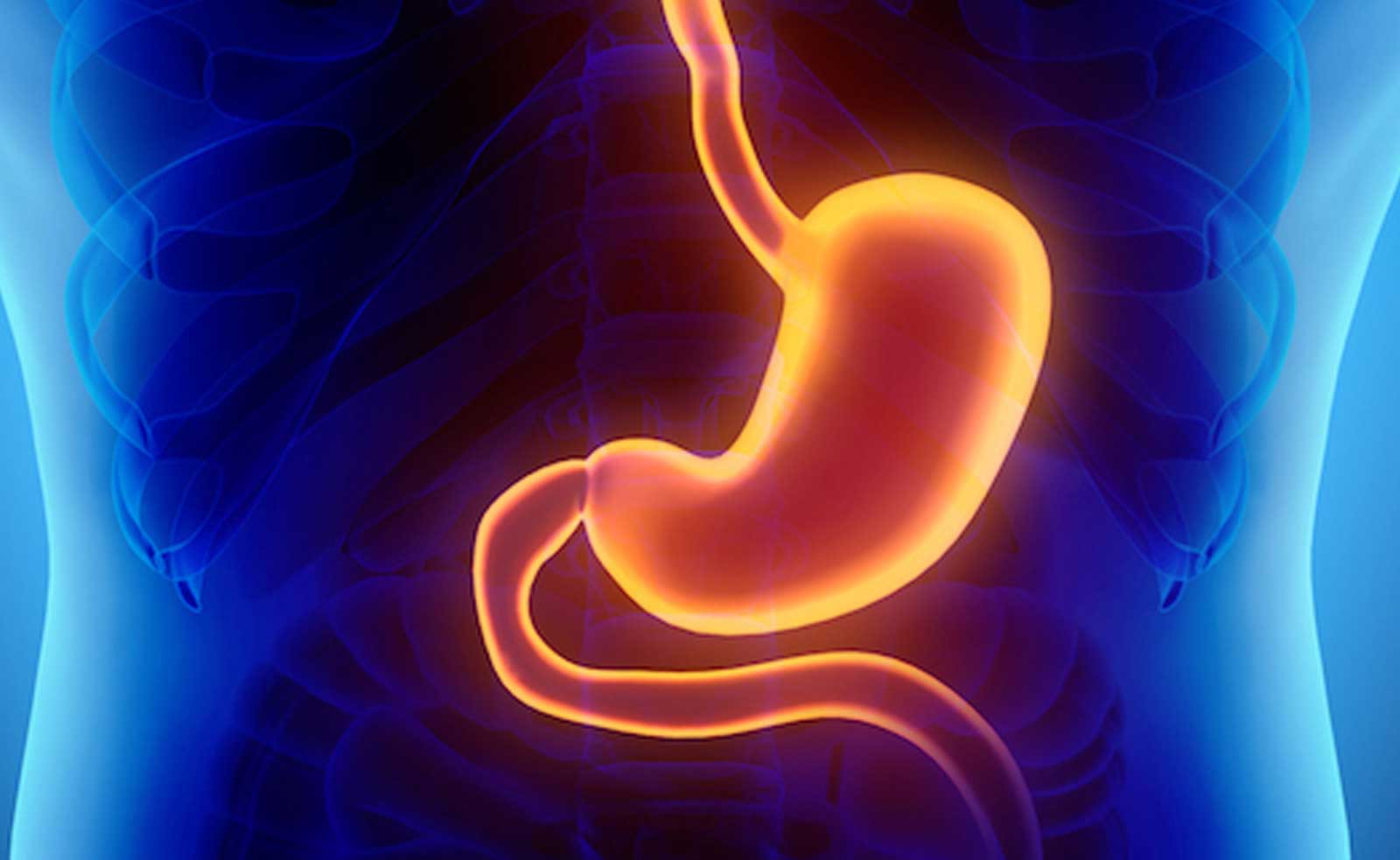 Cuántos tipos de gastritis existen - Cuál es la más peligrosa - Cómo aliviar la gastritis